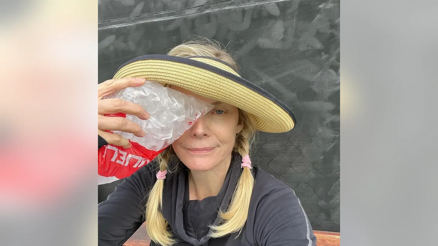 Michelle Pfeiffer Held A Large Bag Of Ice To Her Eye After Being Injured During A Pickleball Game. Michelle Pfeiffer Instagram